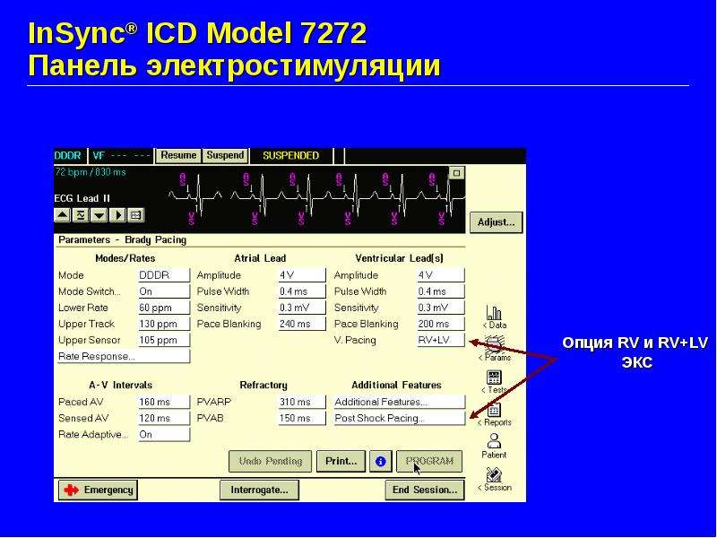 InSync ICD Model Панель
