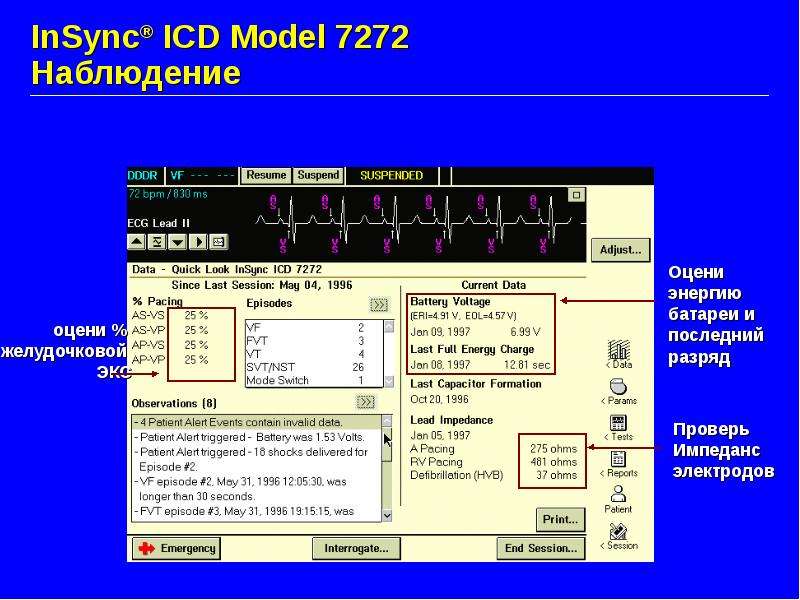 InSync ICD Model Наблюдение