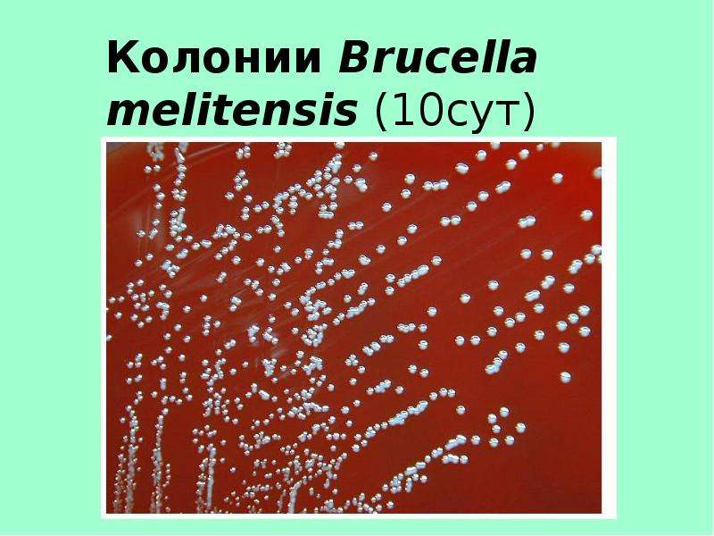 Колонии Brucella melitensis