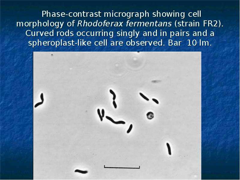 Phase-contrast micrograph