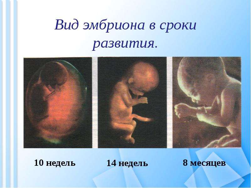 Вид эмбриона в сроки развития.