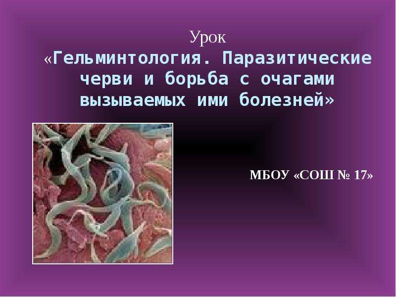 Презентация Урок «Гельминтология. Паразитические черви и борьба с очагами вызываемых ими болезней» МБОУ «СОШ  17»