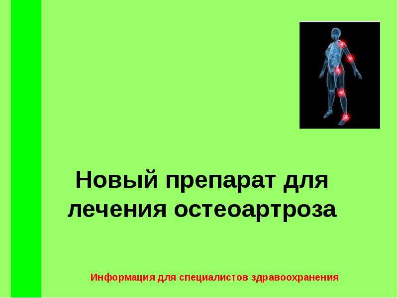 Презентация На тему "Новый препарат для лечения остеоартроза" - скачать презентации по Медицине
