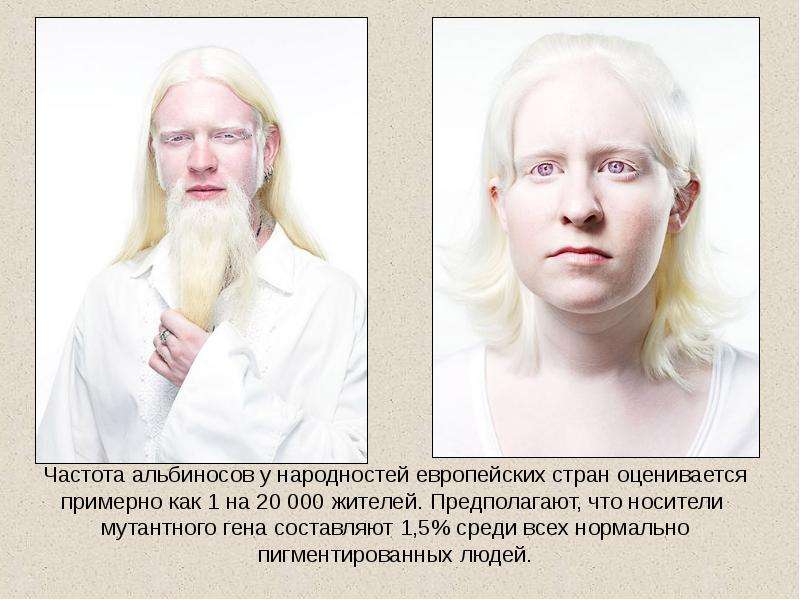 Частота альбиносов у