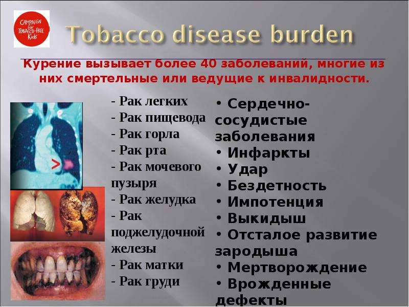 Курение вызывает более