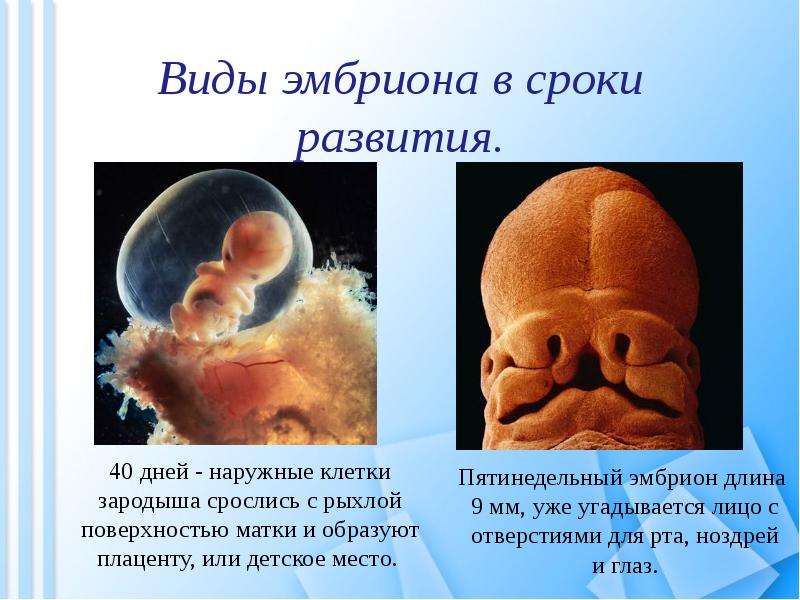 Виды эмбриона в сроки