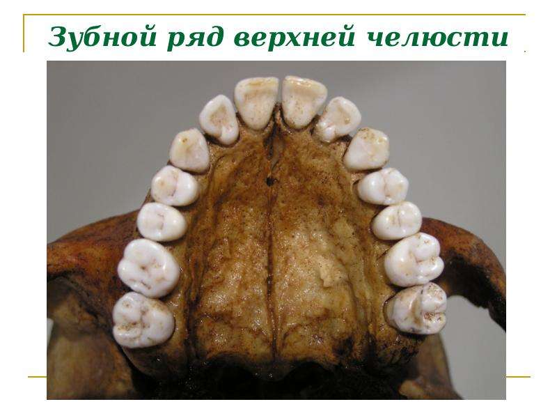 Зубной ряд верхней челюсти