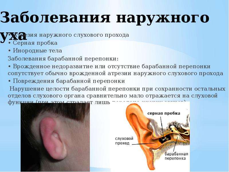 Заболевания наружного уха