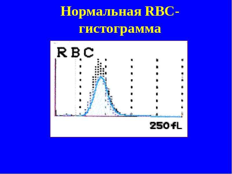 Нормальная RBC- гистограмма