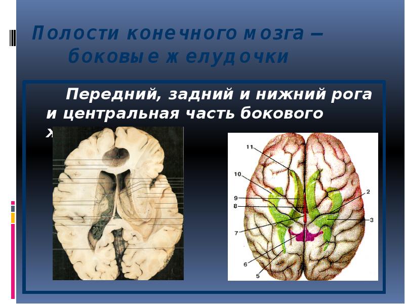 Полости конечного мозга