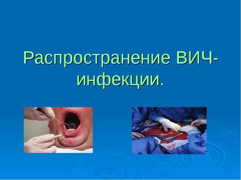 Презентация Предупреждение ВИЧ-инфекции