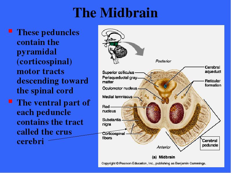 The Midbrain These peduncles