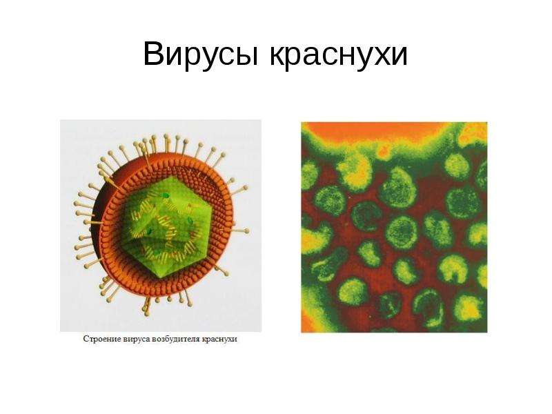 Вирусы краснухи
